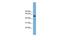 TRNA Methyltransferase 13 Homolog antibody, GTX44927, GeneTex, Western Blot image 