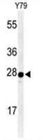 Aralkylamine N-Acetyltransferase antibody, AP50011PU-N, Origene, Western Blot image 