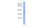 Kelch Like Family Member 40 antibody, PA5-40948, Invitrogen Antibodies, Western Blot image 