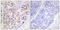 Aurora Kinase B antibody, LS-C198660, Lifespan Biosciences, Immunohistochemistry paraffin image 