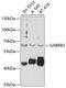 Gamma-Aminobutyric Acid Type A Receptor Beta3 Subunit antibody, 13-375, ProSci, Western Blot image 