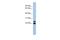 Chromosome 19 Open Reading Frame 54 antibody, A16781, Boster Biological Technology, Western Blot image 