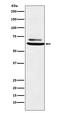Solute Carrier Family 29 Member 2 antibody, M04718-1, Boster Biological Technology, Western Blot image 