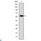Fibrinogen Gamma Chain antibody, LS-C812599, Lifespan Biosciences, Enzyme Linked Immunosorbent Assay image 