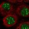 C1D Nuclear Receptor Corepressor antibody, HPA037413, Atlas Antibodies, Immunofluorescence image 