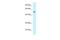 Protein Zfp867 antibody, A30341, Boster Biological Technology, Western Blot image 