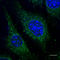 RAB5A, Member RAS Oncogene Family antibody, LS-B12415, Lifespan Biosciences, Immunofluorescence image 