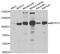 Membrane Bound Transcription Factor Peptidase, Site 1 antibody, A7025, ABclonal Technology, Western Blot image 