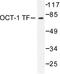 POU Class 2 Homeobox 1 antibody, LS-C176148, Lifespan Biosciences, Western Blot image 