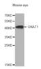 G Protein Subunit Alpha Transducin 1 antibody, abx004980, Abbexa, Western Blot image 