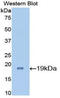Interleukin 7 antibody, MBS2002147, MyBioSource, Western Blot image 