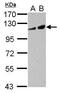 Adenylate Cyclase 2 antibody, PA5-30895, Invitrogen Antibodies, Western Blot image 