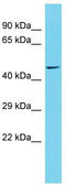 Ribosomal RNA Processing 8 antibody, TA331960, Origene, Western Blot image 