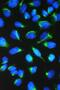 Chaperonin Containing TCP1 Subunit 7 antibody, A08169-2, Boster Biological Technology, Immunofluorescence image 