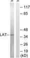 Linker For Activation Of T Cells antibody, LS-C118331, Lifespan Biosciences, Western Blot image 