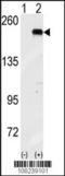 Eukaryotic Translation Initiation Factor 2 Alpha Kinase 4 antibody, TA302175, Origene, Western Blot image 