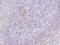 Interferon Regulatory Factor 4 antibody, 202712-T08, Sino Biological, Immunohistochemistry paraffin image 