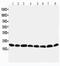 Prdx6 antibody, PA1838, Boster Biological Technology, Western Blot image 