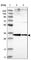 Phosphopantothenoylcysteine Synthetase antibody, HPA031361, Atlas Antibodies, Western Blot image 