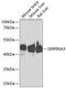 Serpin Family A Member 3 antibody, GTX55503, GeneTex, Western Blot image 