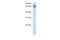 Transcription Factor 25 antibody, A10903, Boster Biological Technology, Western Blot image 