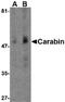 TBC1 Domain Family Member 10C antibody, PA5-20395, Invitrogen Antibodies, Western Blot image 