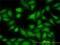 MAP kinase-interacting serine/threonine-protein kinase 1 antibody, H00008569-M06, Novus Biologicals, Immunocytochemistry image 