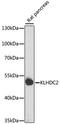 Kelch Domain Containing 2 antibody, LS-C750118, Lifespan Biosciences, Western Blot image 