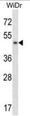 Ankyrin Repeat And Sterile Alpha Motif Domain Containing 4B antibody, AP50191PU-N, Origene, Western Blot image 