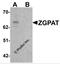 Zinc Finger CCCH-Type And G-Patch Domain Containing antibody, 6611, ProSci, Western Blot image 