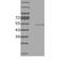 ETS Proto-Oncogene 1, Transcription Factor antibody, FC00931, Boster Biological Technology, Western Blot image 