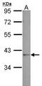 Galactose Mutarotase antibody, GTX123515, GeneTex, Western Blot image 