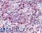 BLT1 antibody, LS-A1492, Lifespan Biosciences, Immunohistochemistry paraffin image 