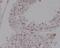 Low Density Lipoprotein Receptor antibody, M00076, Boster Biological Technology, Immunohistochemistry frozen image 