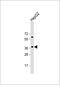 E2F Transcription Factor 5 antibody, GTX80623, GeneTex, Western Blot image 