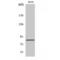 Olfactomedin Like 2B antibody, LS-C385476, Lifespan Biosciences, Western Blot image 