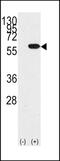 Y-Box Binding Protein 1 antibody, GTX81910, GeneTex, Western Blot image 