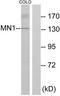 MN1 Proto-Oncogene, Transcriptional Regulator antibody, TA314209, Origene, Western Blot image 