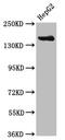 Carbamoyl-Phosphate Synthase 1 antibody, CSB-PA005913LA01HU, Cusabio, Western Blot image 