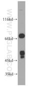 Forkhead Box J3 antibody, 19751-1-AP, Proteintech Group, Western Blot image 