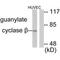 Guanylate Cyclase 1 Soluble Subunit Beta 1 antibody, PA5-49743, Invitrogen Antibodies, Western Blot image 