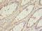 TRNA Selenocysteine 1 Associated Protein 1 antibody, LS-C379870, Lifespan Biosciences, Immunohistochemistry paraffin image 