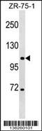 Chloride Voltage-Gated Channel 3 antibody, 58-987, ProSci, Western Blot image 