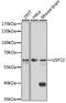 Ubiquitin Specific Peptidase 22 antibody, 18-032, ProSci, Western Blot image 