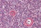 Mitochondrial Antiviral Signaling Protein antibody, MBS240298, MyBioSource, Immunohistochemistry frozen image 