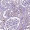 Transmembrane Protein 132E antibody, NBP2-49639, Novus Biologicals, Immunohistochemistry paraffin image 