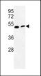Phosphatidylserine Decarboxylase antibody, GTX80997, GeneTex, Western Blot image 