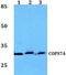 COP9 Signalosome Subunit 7A antibody, PA5-37150, Invitrogen Antibodies, Western Blot image 