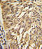 Secretion Associated Ras Related GTPase 1A antibody, A07224-1, Boster Biological Technology, Immunohistochemistry paraffin image 