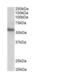 ETS Transcription Factor ERG antibody, NB100-2472, Novus Biologicals, Western Blot image 